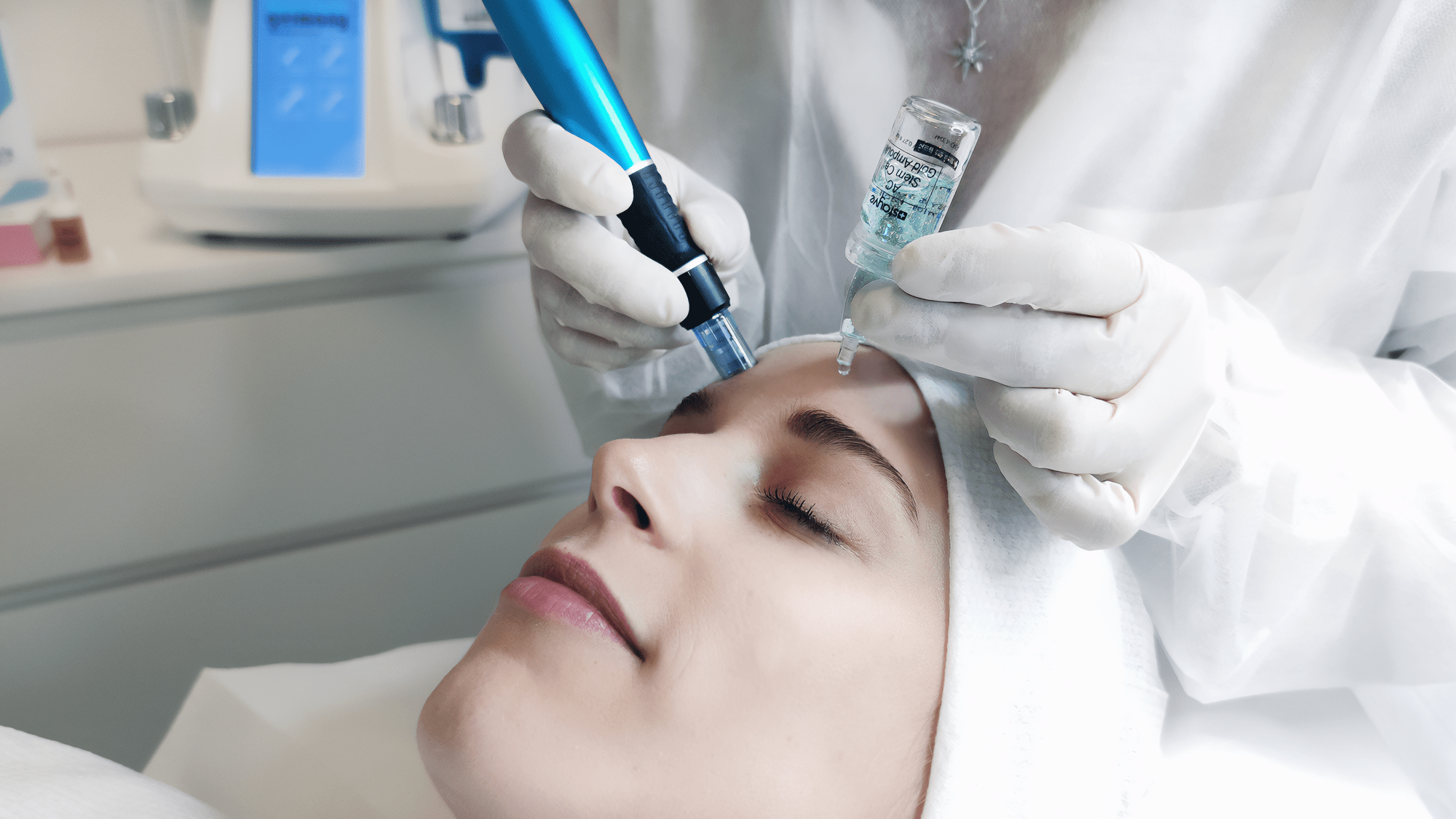 Microneedling by Evelyn Mullis - Beautybox in Kerpen